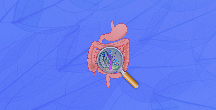 blog 870x445 inflamacion intestinal